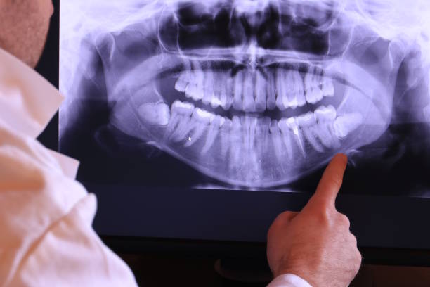 Best Emergency Denture Repair in West Ishpeng, MI